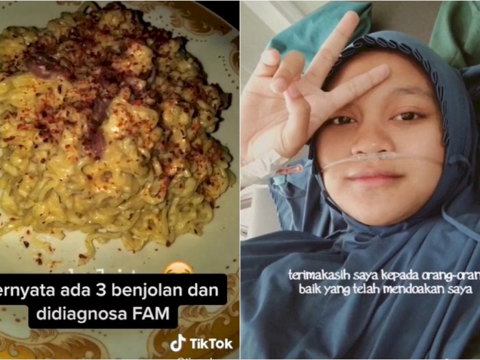 Gadis Ini Kena Tumor Payudara Gegara Terlalu Sering Makan Junk Food dan Micin