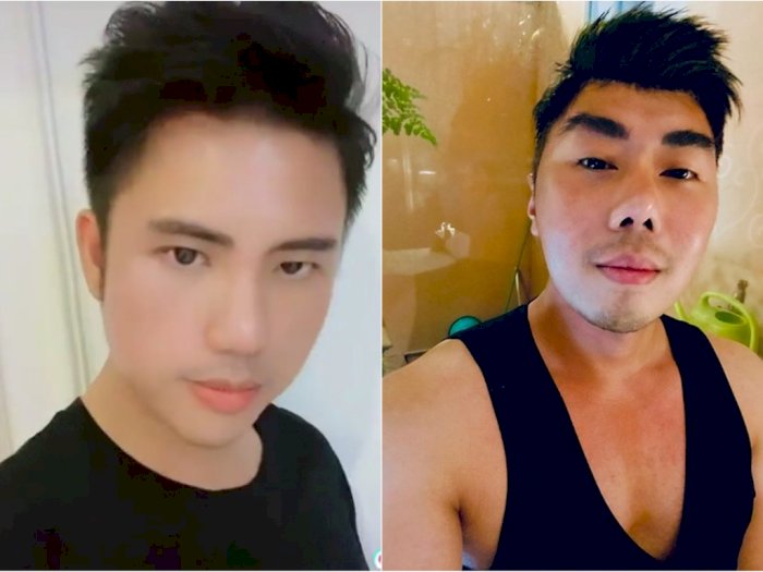 Ricky Cuaca Pamer Potret Tampan Usai Operasi Hidung, Malah Disebut Mirip Roy Kiyoshi