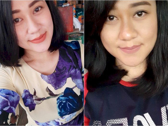 Petaka Memilukan Perawat Cantik di Malang, Dibakar Hidup-hidup, Alami Luka Bakar 60%