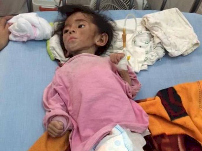 Meski Sempat Diklaim Pencitra, Gadis Muda Ini Berhasil Merawat Bayi Gizi Buruk