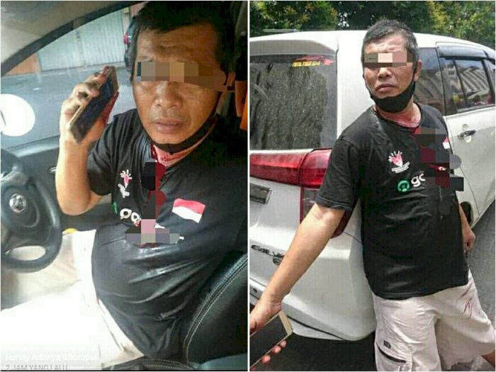 Mengerikan, Driver Taksi Online di Medan Ditusuk Petugas Parkir Gegara Tolak Bayar Parkir