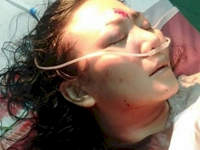 Viral Wanita Luka-luka Dianiaya Ojek Pangkalan di Jaktim, Polisi Sebut Minim Saksi di TKP