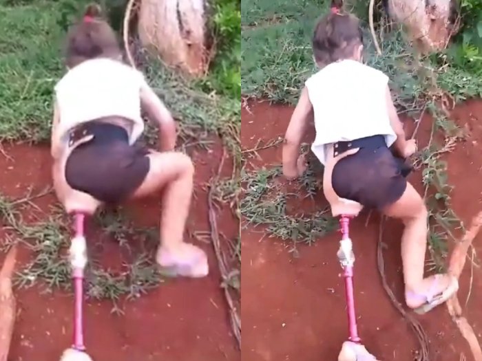 Viral Video Gadis dengan Kaki Prostetik Memanjat Selokan, Dukungan Ibunya Bikin Terharu