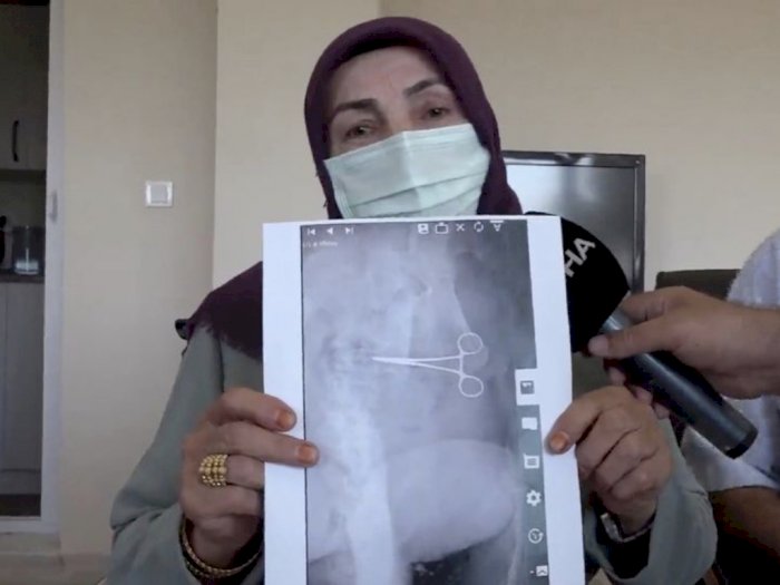 Ngeri, Ada Gunting Tertinggal di Perut Wanita Ini Setelah Operasi Pengencangan Perut