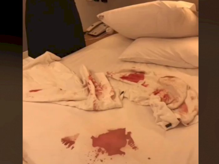 Kasur Hotel Berceceran Darah, Ternyata Pasangan Habis Hubungan Seks, Tolak Ganti Rugi