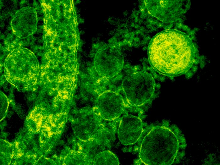 Virus COVID-19 Varian B117 Dikabarkan Ada di Kalsel, Dinkes Tapin Angkat Bicara