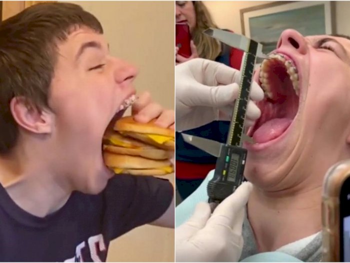 Remaja asal Minnesota Memegang Guinness World Record untuk Mulut Terlebar