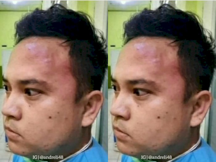 3 Pria Aniaya Perawat di Lampung, Ngaku Keluarga Pejabat Agar Dapat Tabung Oksigen