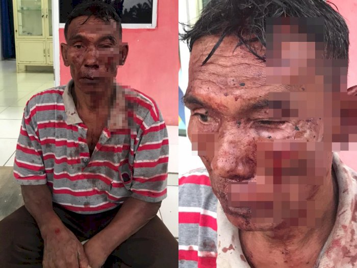 Pria Tua Ini Dipukuli Kepala RT hingga Berdarah di Sekujur Wajah, Netizen: Ya Tuhan!