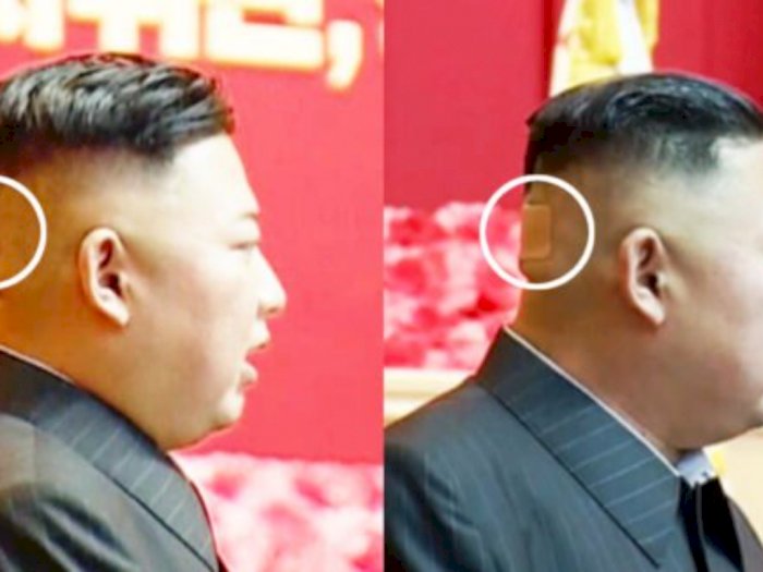 Kepala Kim Jong-un Diplester, Picu Rumor Jika Dirinya  Mengidap Penyakit