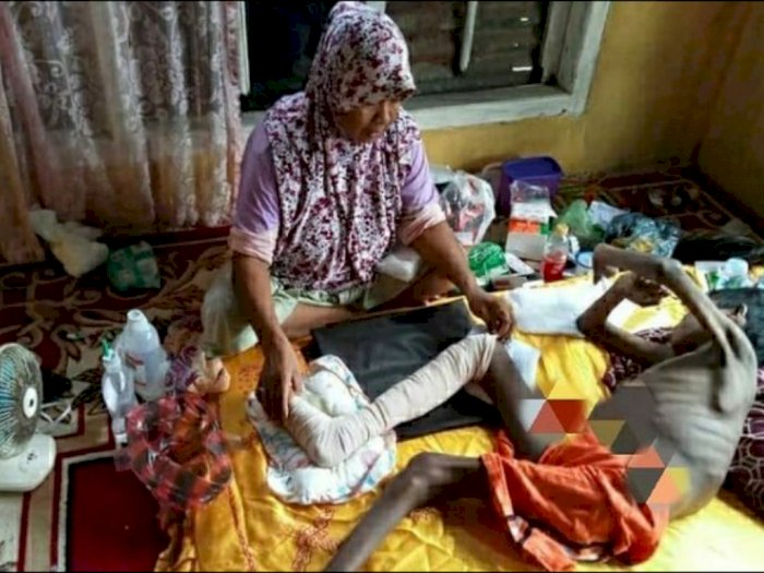 Mengharukan, Tak Memiliki Biaya Berobat, Pemuda Aceh Jaya Menderita Thalasemia Sejak Lahir