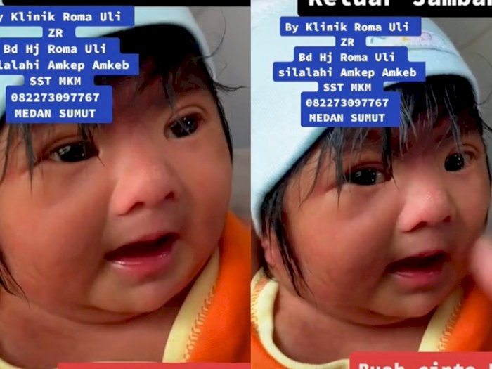 Viral Bayi Baru Lahir Langsung Punya Jambang Rambut dan Poni, Netizen: Ganteng Banget!