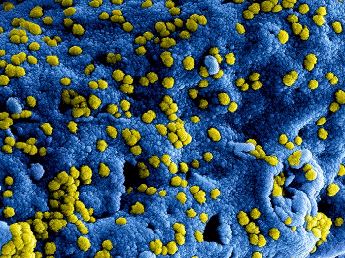 Amerika Serikat Temukan Bakteri Langka Yang Sebabkan Kematian