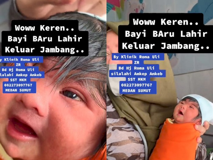 Heboh Bayi Baru Lahir Punya Rambut Panjang, Netizen:  Ada Salon Dalam Perut!