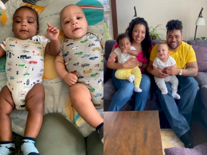 Viral Seorang Ibu Melahirkan Anak Kembar dengan Dua Warna Kulit yang Berbeda