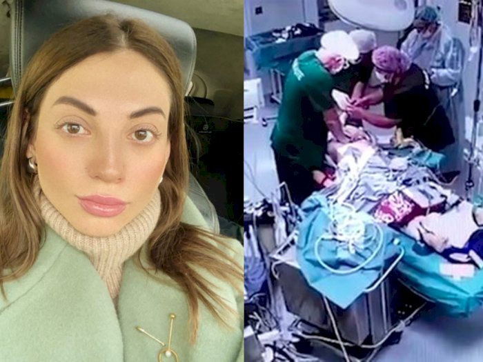 Tragis, Influencer Ini Meninggal saat Prosedur Operasi Hidung di Klinik Elit di Rusia