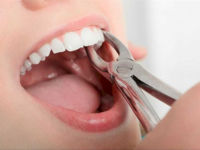 Mantap! Mahasiswa UB Buat Gelfoam Penghilang Luka Pascapencabutan Gigi