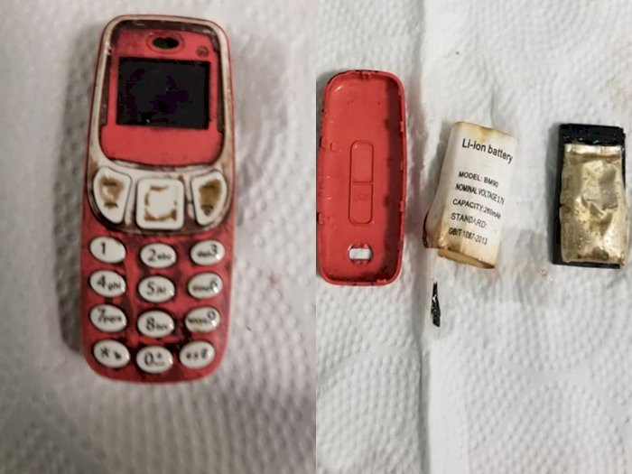 Pria Ini Terpaksa Menjalani Operasi Setelah Menelan Ponsel Nokia Versi 3310