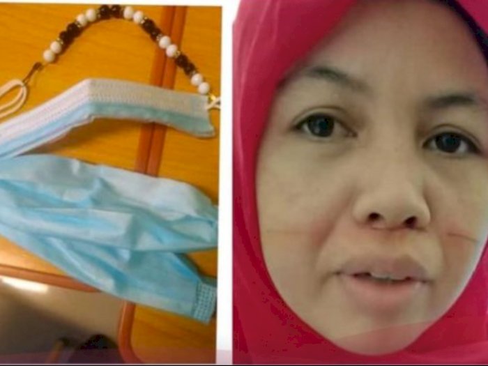 Wajah Guru SD di Lampung Ini Luka Kena Sayat Benang Layang-layang, Masker Sampai Robek