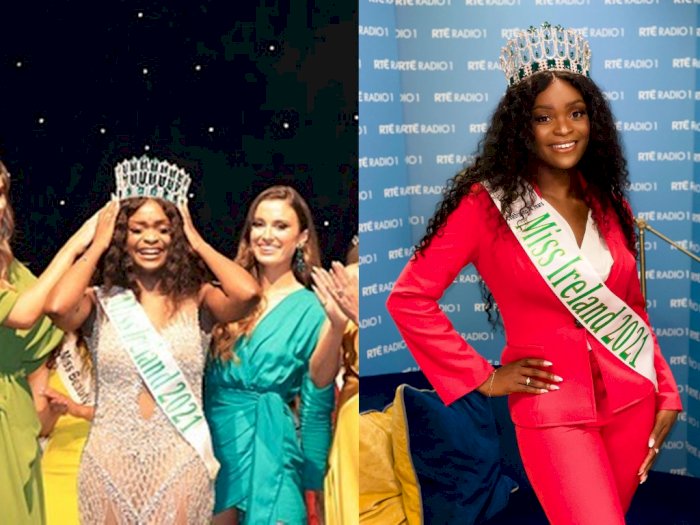 Cerita Miss Irlandia yang Kerap Mendapat Komentar Rasis karena Warna Kulitnya