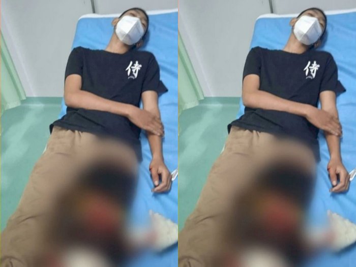 Remaja 15 Tahun di Tangsel Jadi Korban Begal, Motor Raib dan Kaki Dibacok Sajam