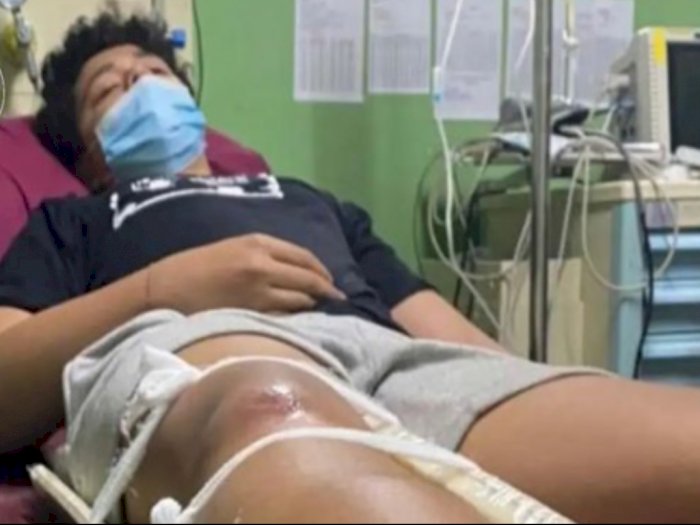 Bocah SMP Diduga Dianiaya Oknum Polisi di Denpasar, Disetrum dan Kaki Diinjak Hingga Patah
