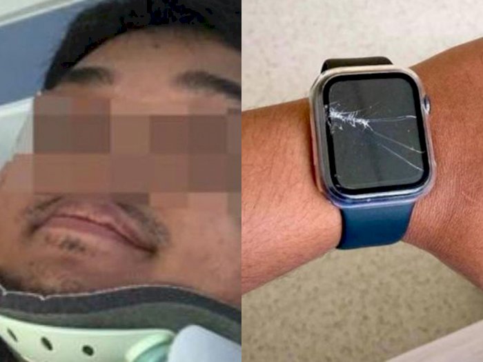 Beruntung! Pria Berhasil Selamat dari Kecelakaan Berkat Apple Watch-nya Menelpon Ambulans