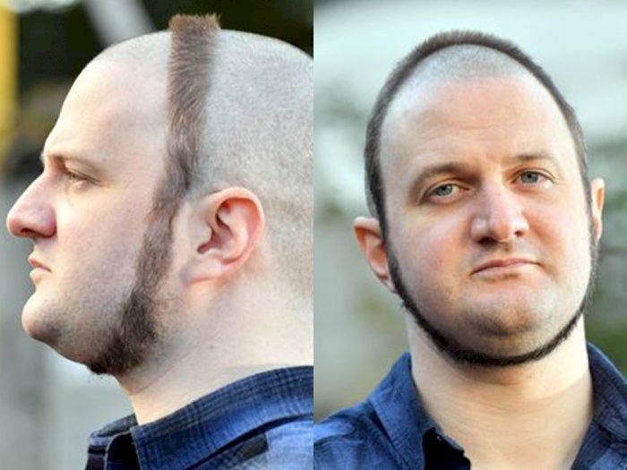 Pria Ini Cukur Rambut & Janggut Seperti Cincin di Wajah, Ada Alasan Mengharukan Dibaliknya