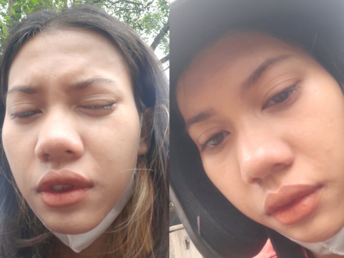Curhat Wanita Korban Perokok di Jalan, Mata Pedih Terkena Bara Rokok