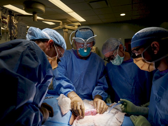 Ahli Bedah di AS Berhasil Transplantasi  Ginjal Babi ke Tubuh Manusia, Ini Rahasianya