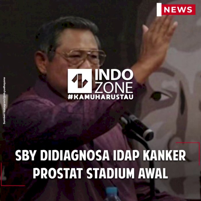 SBY Didiagnosa Idap Kanker Prostat Stadium Awal