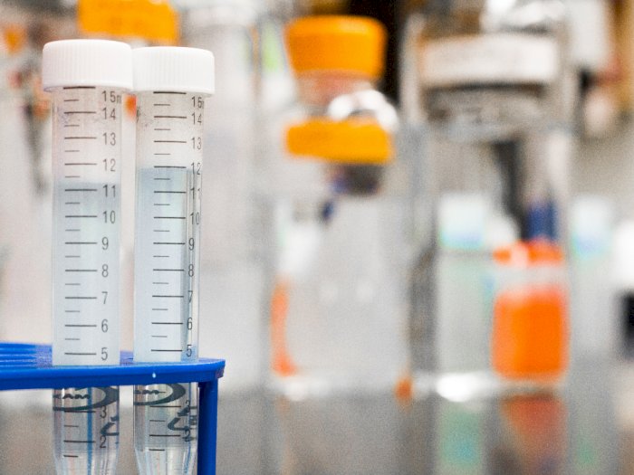 Waduh, Ada Belasan Botol Berlabel 'Cacar' di Lab Yang Ada di Amerika Serikat