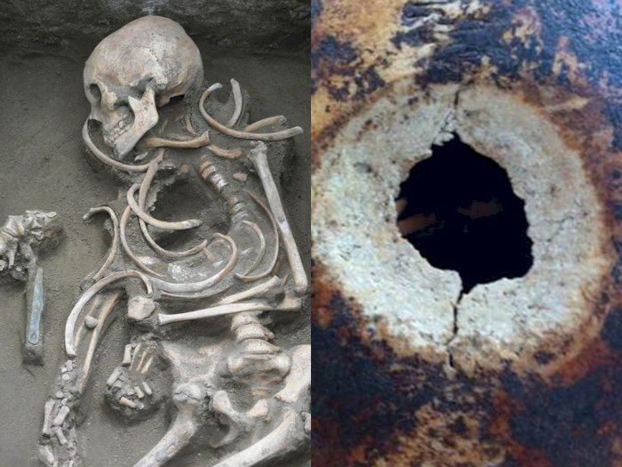 Penemuan Tengkorak Kuno oleh Peneliti Mengungkapkan Proses Pembedahan 2.300 Tahun Lalu!