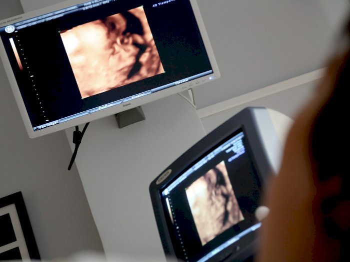 Pemerintah Beri Layanan Pemeriksaan USG Kehamilan  di Puskesmas, Biaya Ditanggung BPJS