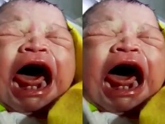 Unik! Bayi di Labura Ini Terlahir Punya Sejumlah Gigi