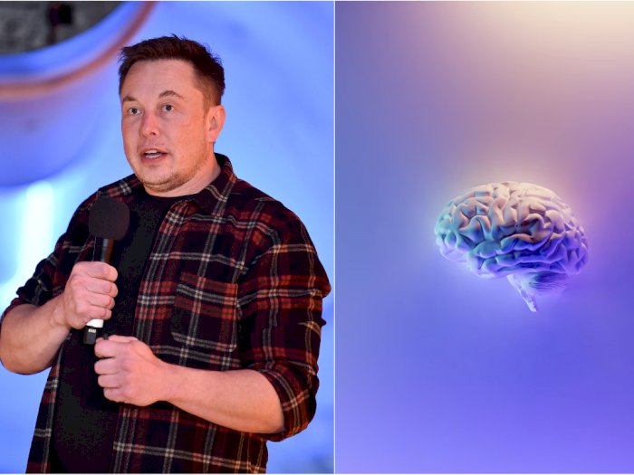 Masa Depan! Elon Musk akan Tanam Chip di Otak Manusia, Bisa Main Hp dengan Pikiran