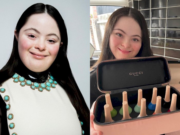 Alami Down Syndrome, Remaja Ini Buktikan Dirinya Bisa Jadi Model Brand Ternama