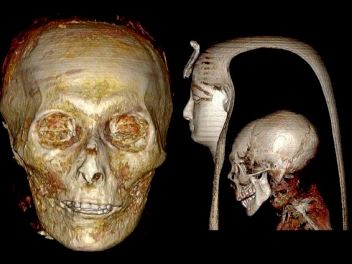 Ilmuwan Akhirnya Mempelajari Tubuh Mumi Firaun Untuk Mengetahui Isi di Dalam Tubuhnya