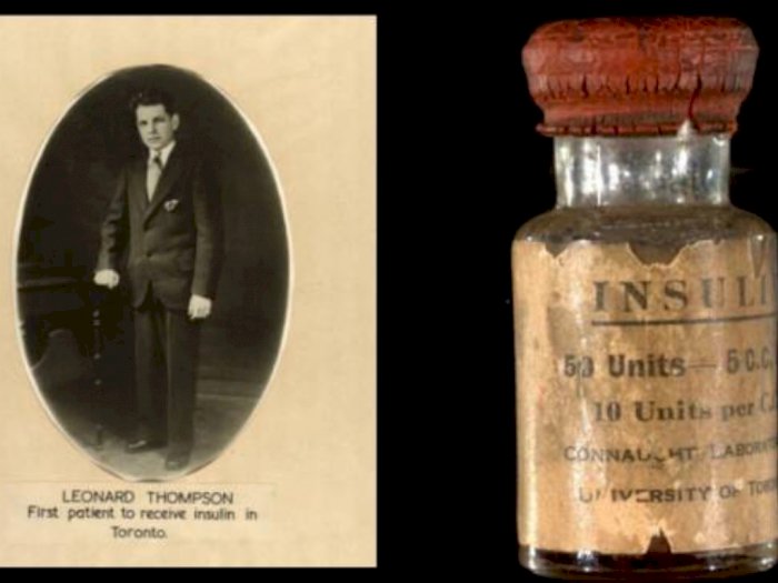 Hari Ini dalam Sejarah 11 Januari: Insulin Pertama Kali Digunakan untuk Penderita Diabetes