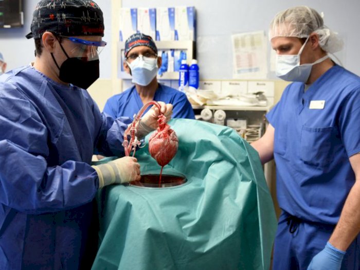 Transplantasi Jantung Babi ke Manusia Berhasil, Pertama Kalinya dalam Sejarah