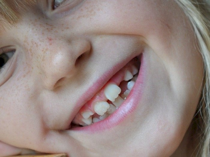 Mitos Melempar Gigi yang Copot ke Genteng Agar Tumbuh Gigi Baru, Ada Buktinya?