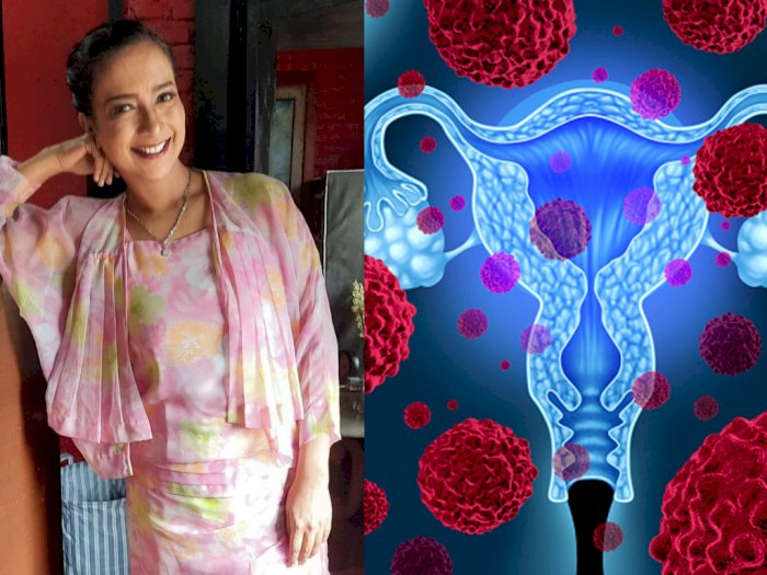 Pernah Idap Kanker Ovarium, Shahnaz Haque Ajak Perempuan Mengenal Gejala dan Penanganannya
