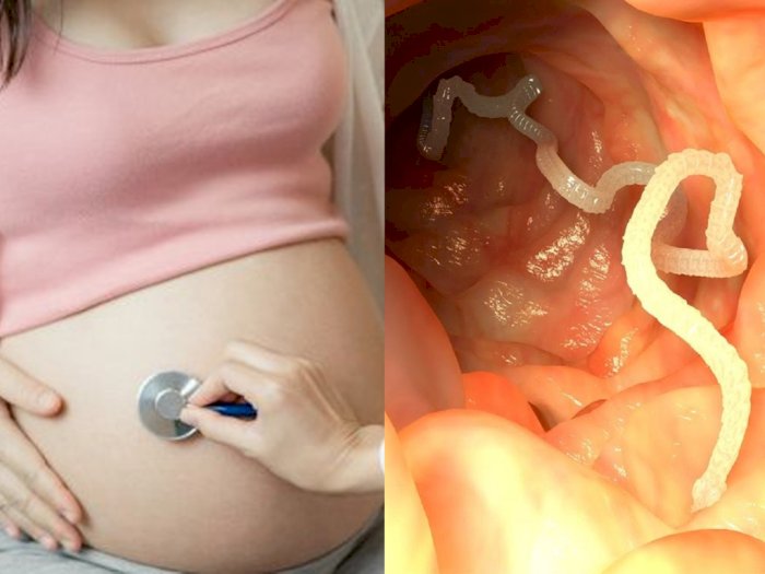 Bukan Belatung, Cacing Kremi yang Bisa Hidup di Organ Intim Wanita, Ini Cara Mencegahnya