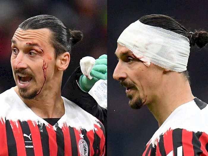 Zlatan Ibrahimovic sudah Berdarah-darah, AC Milan hanya Mampu Imbangi Bologna
