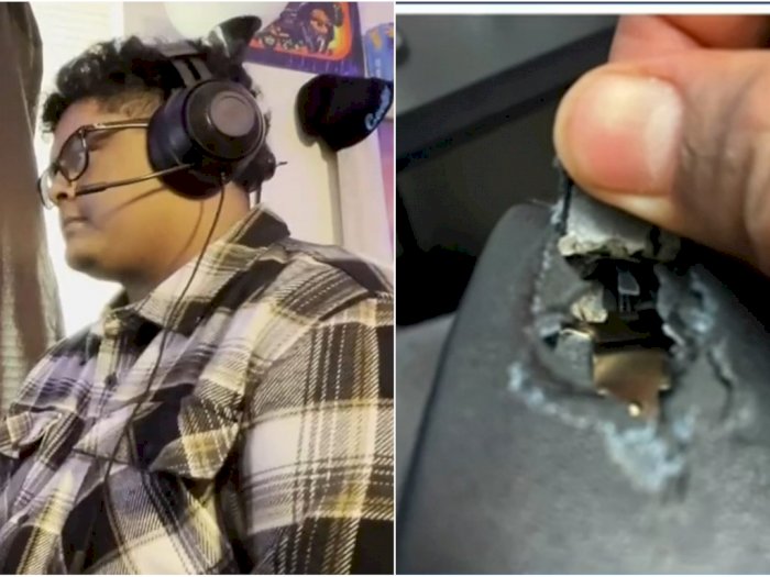 Nyaris Tewas, Remaja Ini Selamat dari Peluru Nyasar Berkat Headset