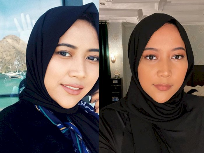 Potret Dagu Lancip Nadia Hasna, Putri Bupati Bogor Ade Yasin yang Ditangkap KPK