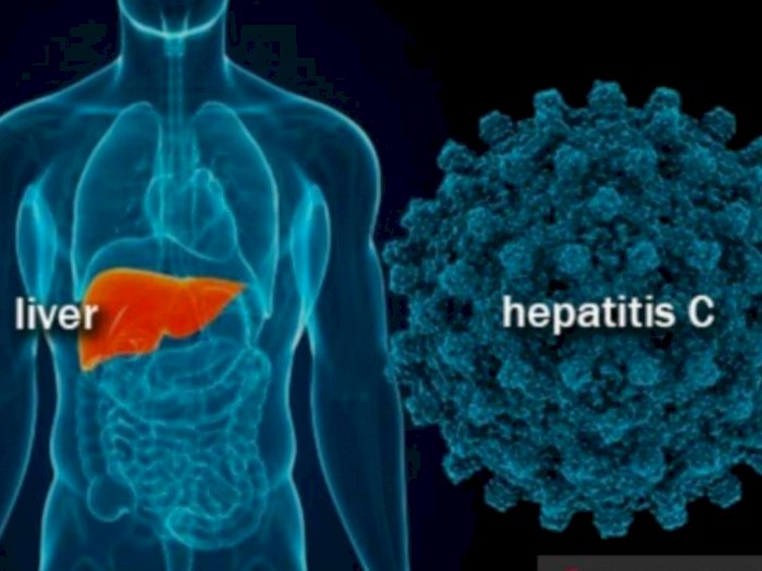 3 Pasien Hepatitis Akut Meninggal Menyerang Anak Secara Misterius, Berikut Ini Gejalanya