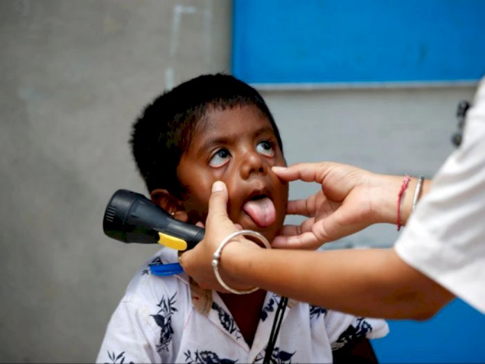 Pemerintah Lakukan Investigasi Kontak 3 kasus Hepatitis Akut pada Anak