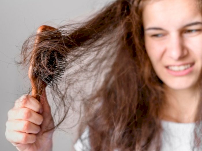 Jangan Stres, Ini 5 Cara Mengatasi Rambut Rontok Parah Mudah Banget