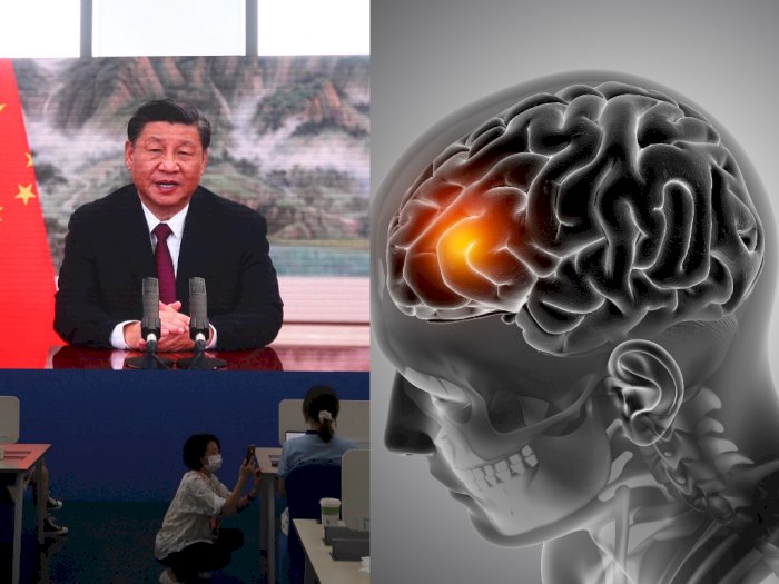 Diidap Presiden China Xi Jinping, Berikut yang Harus Diketahui Mengenai Aneurisma Otak